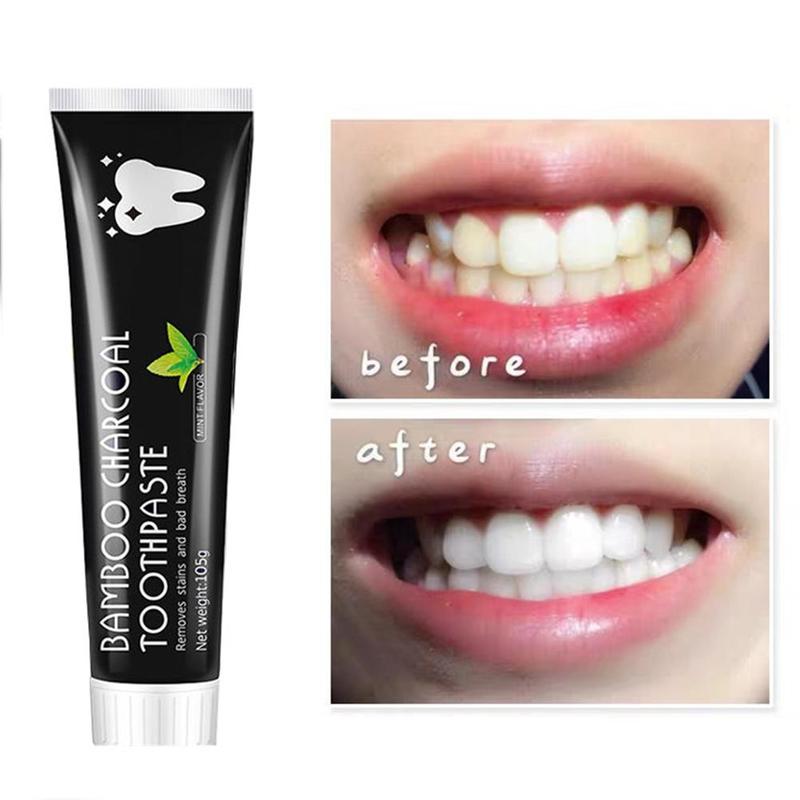 Teeth Whitening Charcoal - 歯のホワイトニング効果のある、活性炭配合のミント風味の天然歯磨き粉。歯の汚れを徹底的に除去し、口腔ケアに最適。竹炭歯磨き粉。