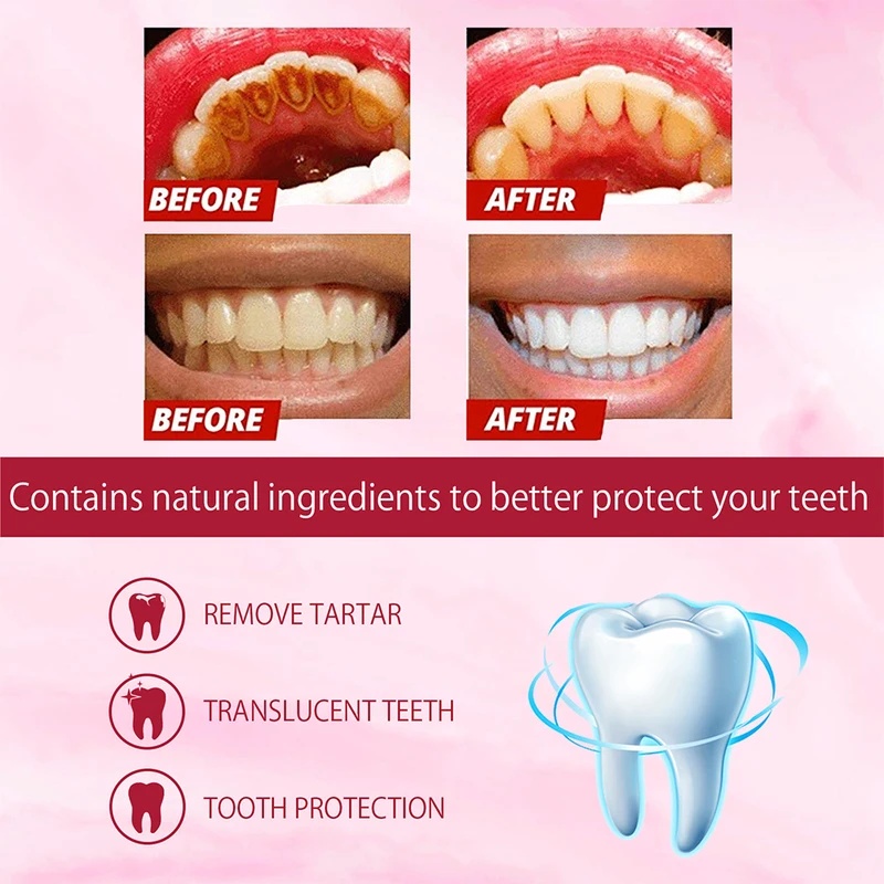 SP-4 プロバイオティクス配合のホワイトニング歯磨き粉。歯 - Teeth Whitening Enzymes のレビューと価格