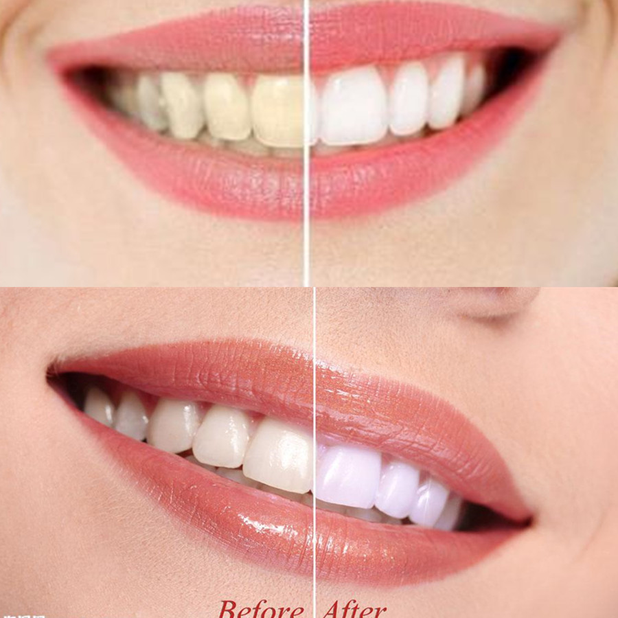 竹炭歯,口腔衛生,煙のホワイトニング,新鮮な呼吸のための歯の - Teeth Whitening Charcoal のレビューと価格