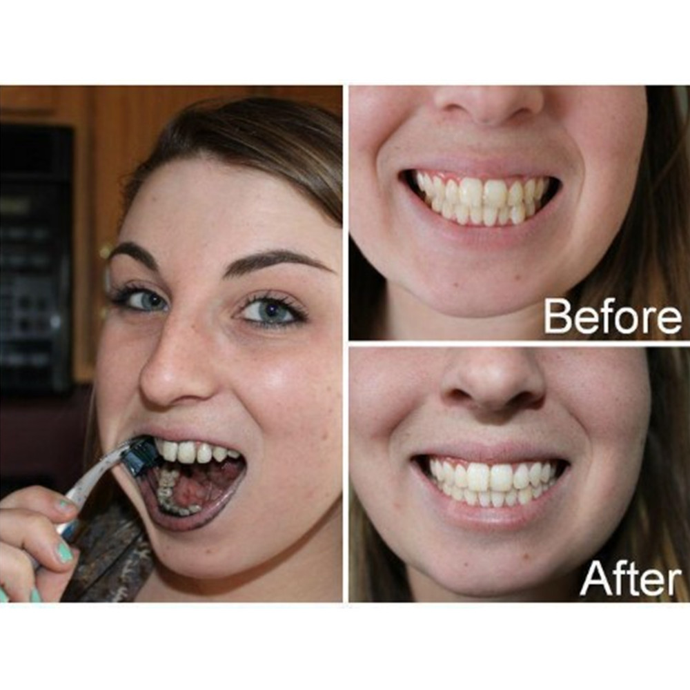 竹炭歯,口腔衛生,煙のホワイトニング,新鮮な呼吸のための歯の - Teeth Whitening Charcoal のレビューと価格