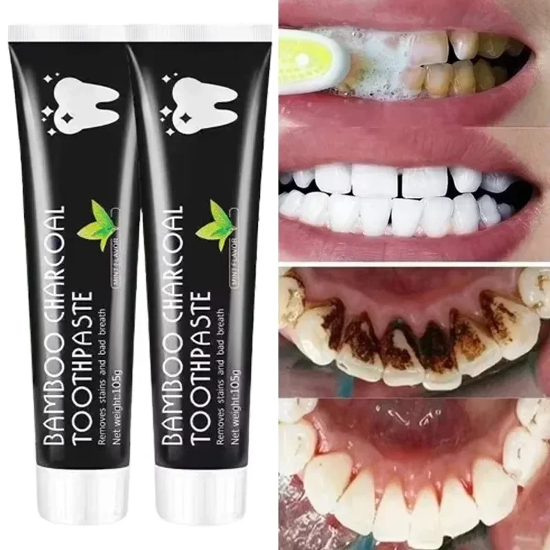 竹炭配合のホワイトニング歯磨き粉。口腔ケアに最適。強力な洗浄 - Teeth Whitening Charcoal のレビューと価格