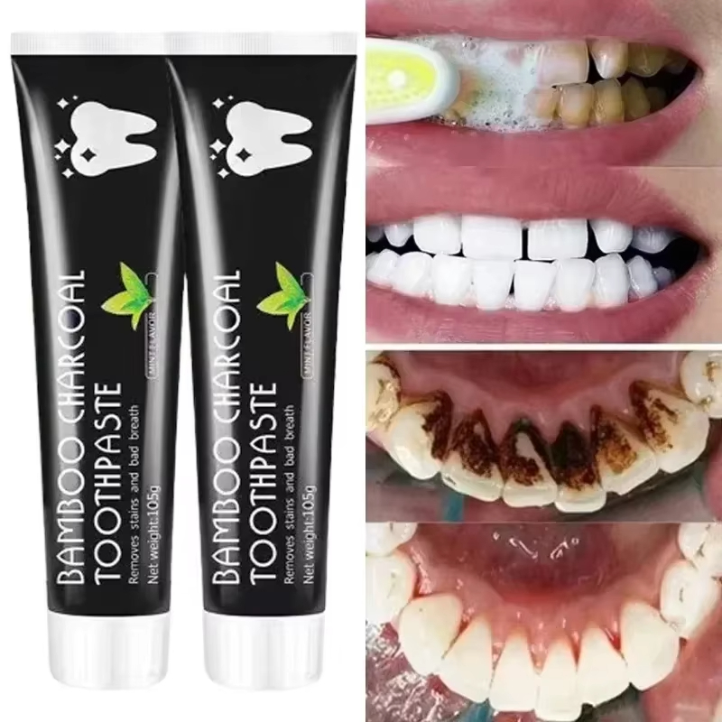 ホワイトニング歯磨き粉 竹炭歯磨き粉 口臭を吸収し、黄色い歯 - Teeth Whitening Charcoal のレビューと価格