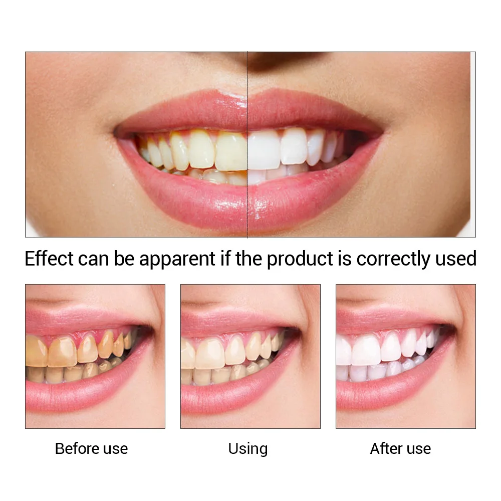 歯のホワイトニングエッセンス,口腔衛生,歯のホワイトニング, - Teeth Whitening Clinic のレビューと価格
