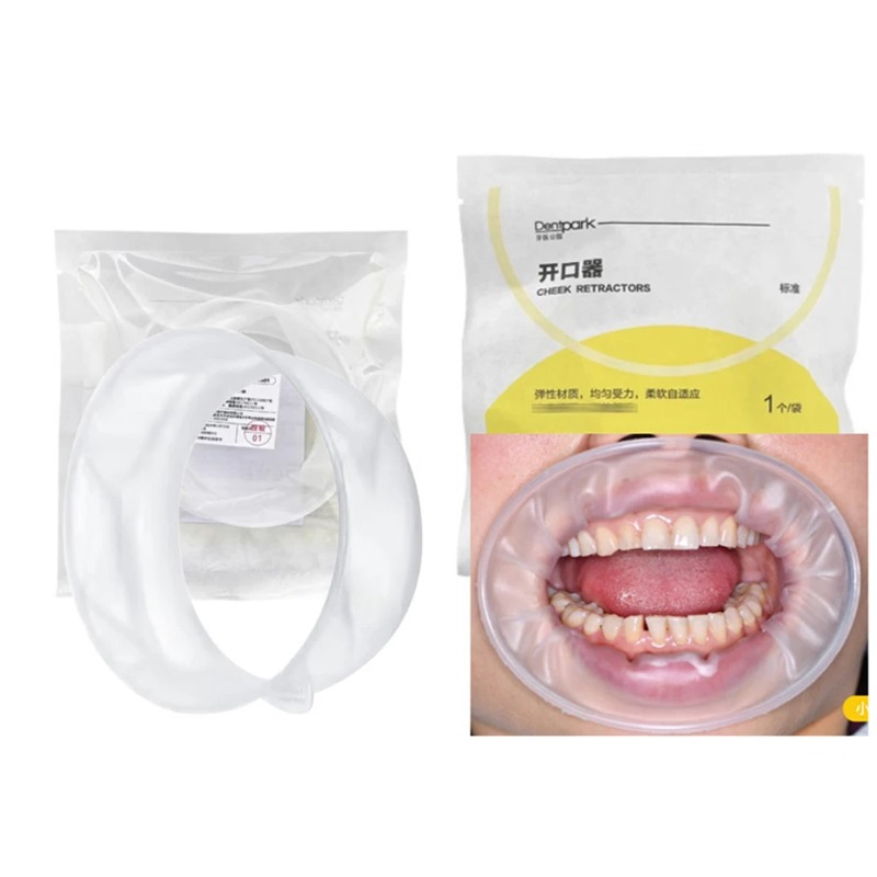 20 個 Dentpark O 字型口腔頬リトラクター使い捨 - Teeth Whitening Clinic のレビューと価格